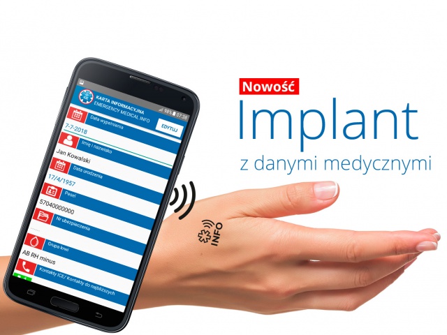 implant_2